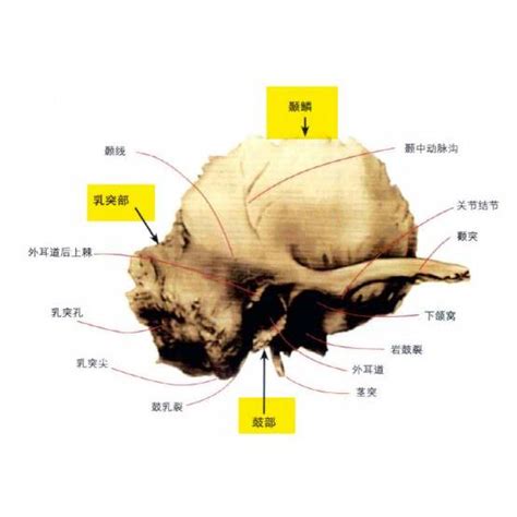 乳突穴|乳突 (顳骨乳突):定義,結構,分類,功能,相關解剖,